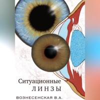 Валерия Алексеевна Вознесенская. Ситуационные линзы